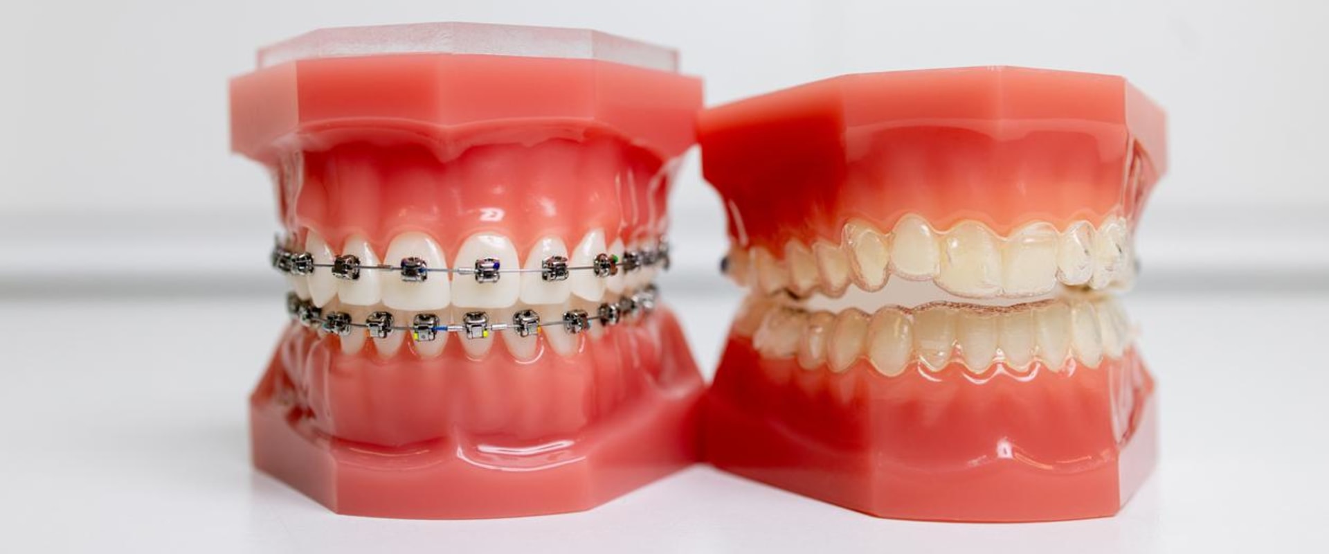 What Exercises Should I Do After Orthodontic Treatment?