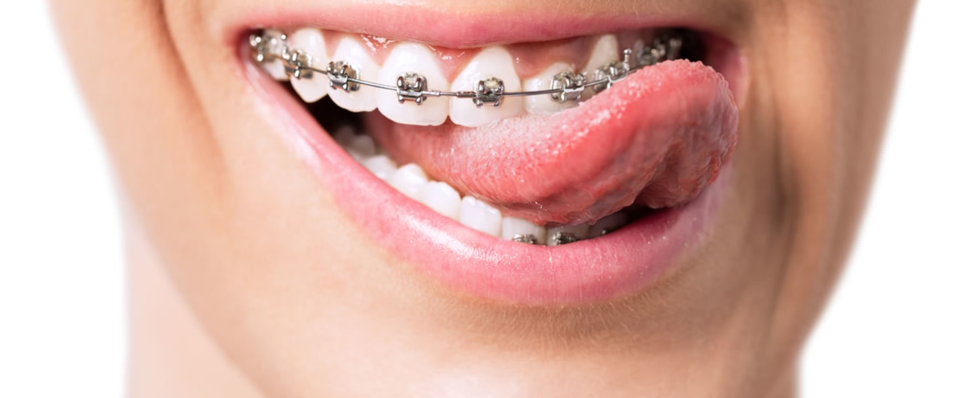 What is an Orthodontist and What Do They Do? - A Comprehensive Guide