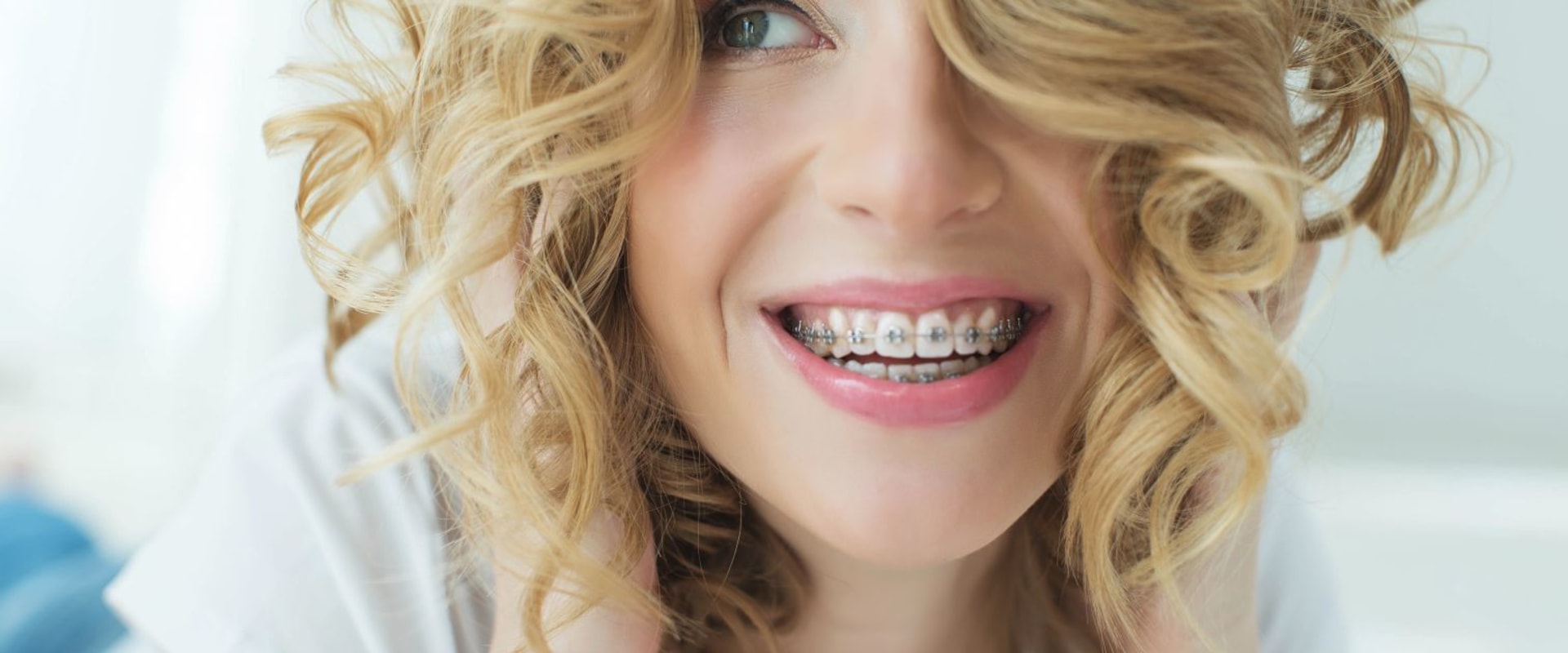 7 Tips to Make Living Easier with Braces