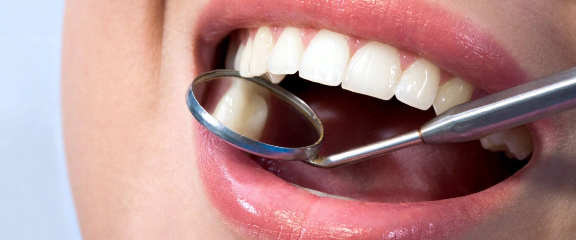 Do Orthodontists Offer Payment Plans for Orthodontic Treatment?