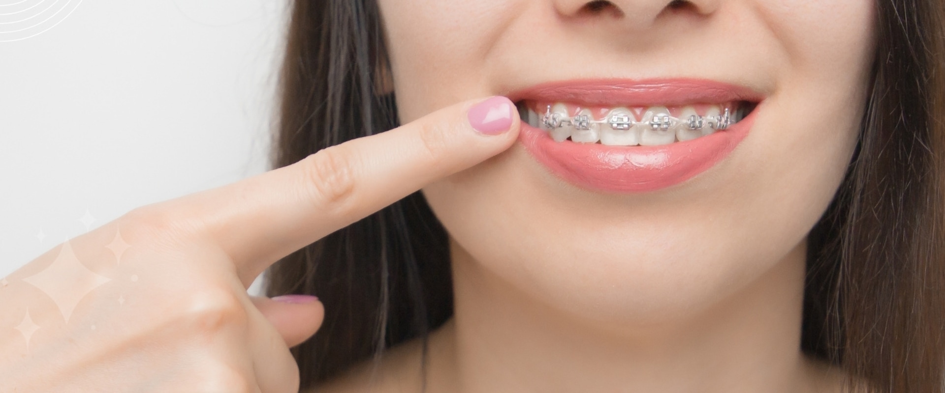 What is the Cheapest Way to Pay for Braces?