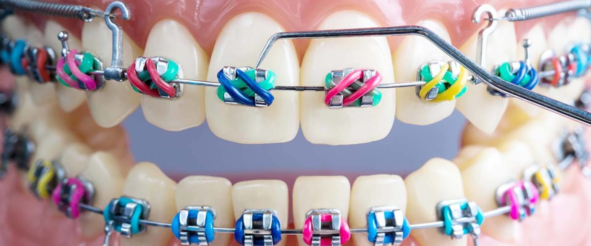 What Treatments Do Orthodontists Provide?