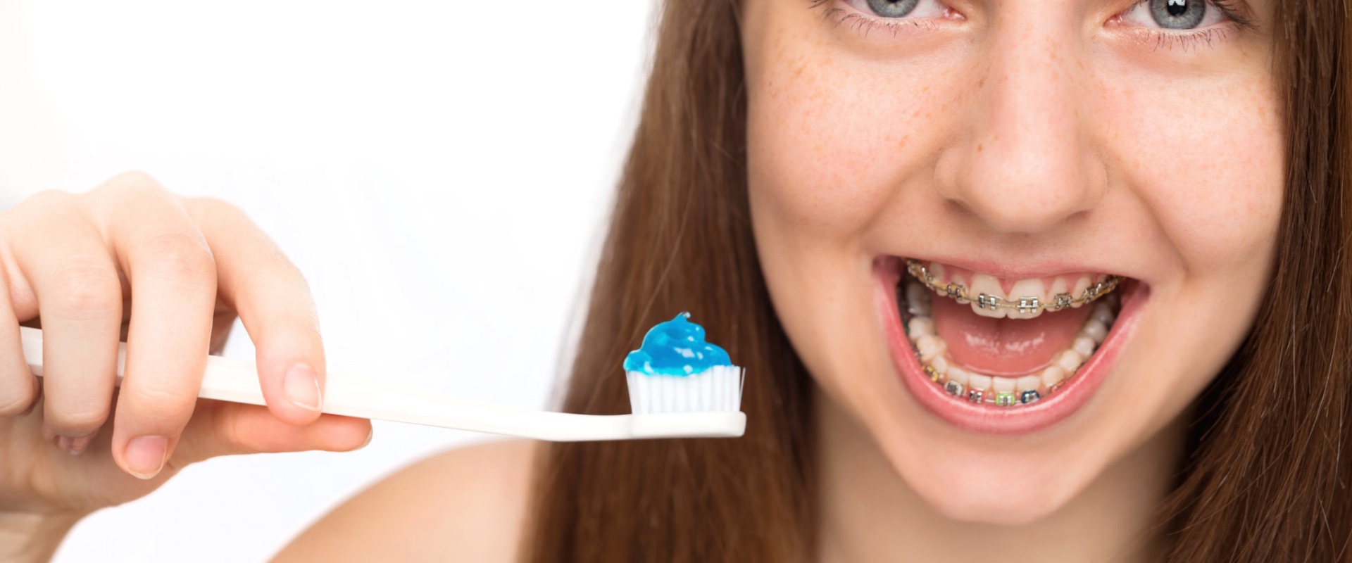 Preventing Gum Disease During Orthodontic Treatment: A Guide for Braces Wearers