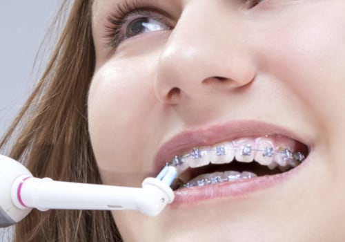 Maintaining Oral Health During Orthodontic Treatment: Tips for a Successful Journey