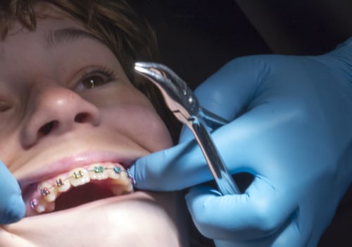 Do Orthodontists Need to Go Through Medical School?