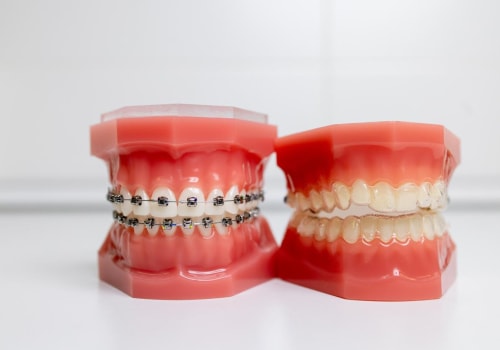 What Exercises Should I Do After Orthodontic Treatment?