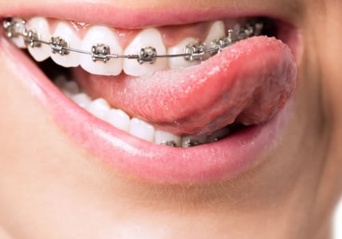 What is an Orthodontist and What Do They Do? - A Comprehensive Guide