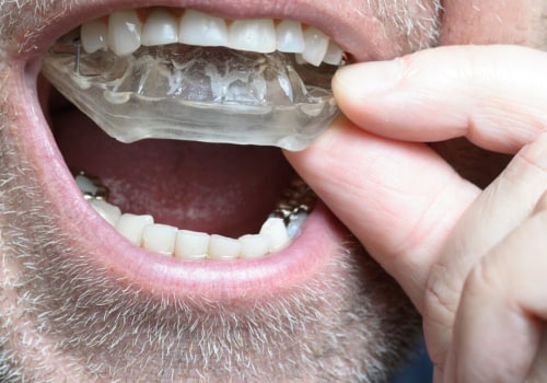 How Orthodontic Treatment Can Help Stop Tooth Grinding