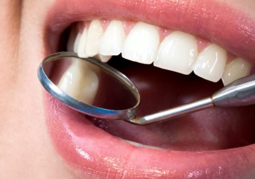 Do Orthodontists Offer Payment Plans for Orthodontic Treatment?