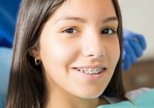 What to Know During the First Week of Getting Braces