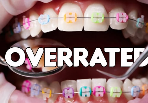 What is the Cost of Orthodontic Treatment? A Comprehensive Guide to Finding an Affordable Option