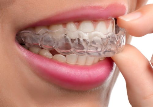 Sedation Options for Orthodontic Treatment: What You Need to Know