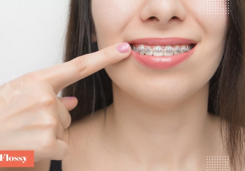 What is the Cheapest Way to Pay for Braces?
