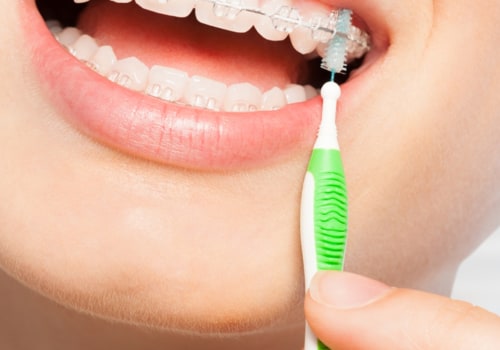 What Activities Should I Avoid During Orthodontic Treatment?
