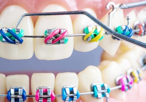 What Treatments Do Orthodontists Provide?