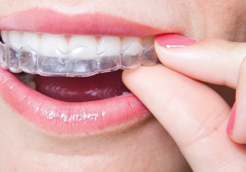 Special Techniques to Use During Orthodontic Treatment